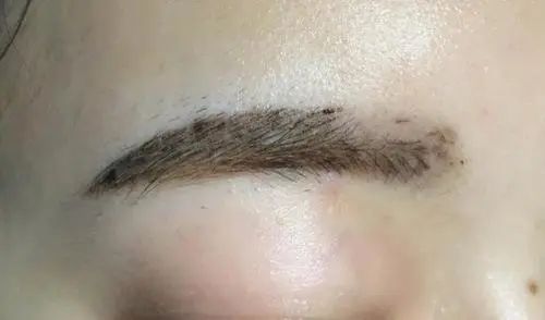 不得不看!野生眉操作不当后期易出现的问题及解决办法